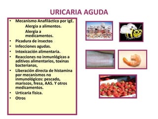 URICARIA AGUDA
• Mecanismo Anafiláctico por IgE.
Alergia a alimentos.
Alergia a
medicamentos.
• Picadura de insectos
• Infecciones agudas.
• Intoxicación alimentaria.
• Reacciones no inmunlógicas a
aditivos alimentarios, toxinas
bacterianas,
• Liberación directa de histamina
por mecanismos no
inmunológicos: pescado,
mariscos, fresa, AAS. Y otros
medicamentos.
• Urticaria física.
• Otros
 