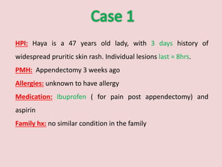 Hpi Template Rash Urticaria - Dr Maryam K Alnajem | PPTX