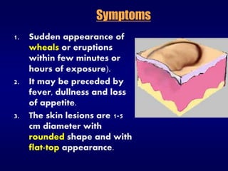 Symptoms
1. Sudden appearance of
wheals or eruptions
within few minutes or
hours of exposure.
2. It may be preceded by
fever, dullness and loss
of appetite.
3. The skin lesions are 1-5
cm diameter with
rounded shape and with
flat-top appearance.
 
