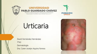 Urticaria
David Hernández Hernández
7ºA3
Dermatología
Dra. Caren Jocelyn Aquino Ferrera
 