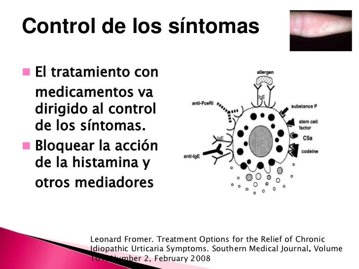 Doxepin Reviews Hives