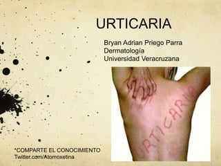 URTICARIA
Bryan Adrian Priego Parra
Dermatología
Universidad Veracruzana
*COMPARTE EL CONOCIMIENTO
Twitter.com/Atomoxetina
 
