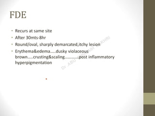 Urticaria and drug eruptions | PPT