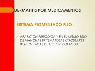 ERITEMA PIGMENTADO FIJO :
APARICION PERIODICA Y EN EL MISMO SITIO
DE MANCHAS ERITEMATOSAS CIRCULARES
BIEN LIMITADAS DE COLOR VIOLACEO.
 