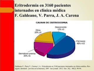 Eritrodermia en 3160 pacientes
internados en clínica médica
F. Galdeano, V. Parra, J. A. Carena
Galdeano F., Parra V., Carena J. A.. Eritrodermia en 3160 pacientes internados en clínica médica. Rev.
argent. dermatol. [revista en la Internet]. 2007 Jun [citado 2012 Ene 26] ; 88(2): 90-94.
 