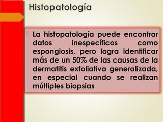  La histopatología puede encontrar
datos inespecíficos como
espongiosis, pero logra identificar
más de un 50% de las causas de la
dermatitis exfoliativa generalizada,
en especial cuando se realizan
múltiples biopsias
 