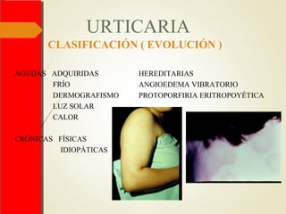 URTICARIA
CLASIFICACIÓN ( EVOLUCIÓN )
AGUDAS ADQUIRIDAS
FRÍO
DERMOGRAFISMO
LUZ SOLAR
CALOR
CRÓNICAS FÍSICAS
IDIOPÁTICAS
HEREDITARIAS
ANGIOEDEMA VIBRATORIO
PROTOPORFIRIA ERITROPOYÉTICA
 