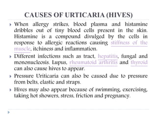 Utirical Rash Hives Urticaria Causes