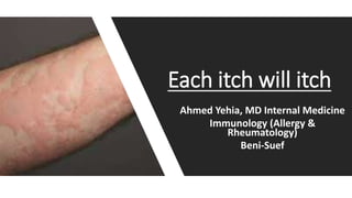 Ahmed Yehia, MD Internal Medicine
Immunology (Allergy &
Rheumatology)
Beni-Suef
Each itch will itch
 