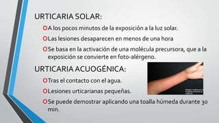 URTICARIA SOLAR: 
oA los pocos minutos de la exposición a la luz solar. 
oLas lesiones desaparecen en menos de una hora 
oSe basa en la activación de una molécula precursora, que a la 
exposición se convierte en foto-alérgeno. 
URTICARIA ACUOGÉNICA: 
oTras el contacto con el agua. 
oLesiones urticarianas pequeñas. 
oSe puede demostrar aplicando una toalla húmeda durante 30 
min. 
 