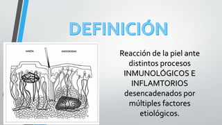 Reacción de la piel ante 
distintos procesos 
INMUNOLÓGICOS E 
INFLAMTORIOS 
desencadenados por 
múltiples factores 
etiológicos. 
 