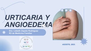 URTICARIA Y
ANGIOEDEMA
Dra. Lizbeth Zapata Rodríguez
R3 de Medicina Familiar
AGOSTO, 2023.
 