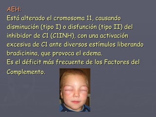 (2012-04-03)Urticaria y angioedema.ppt