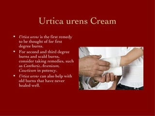 Urtica urens Cream ,[object Object],[object Object],[object Object]