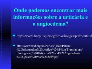 Onde podemos encontrar mais
informações sobre a urticária e
       o angioedema?
   http://www.fmrp.usp.br/cg/novo/images/pdf/conteud

   http://www.bad.org.uk/Portals/_Bad/Patient
    %20Information%20Leaflets%20(PILs)/Translations/
    [Portuguese]%20Urticaria%20and%20Angioedema
    %20Update%20Mar%202009.pdf
 