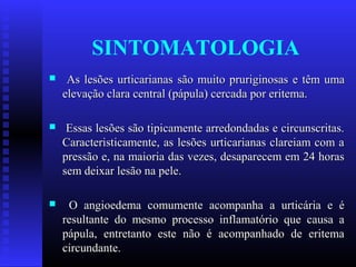 SINTOMATOLOGIA
    As lesões urticarianas são muito pruriginosas e têm uma
    elevação clara central (pápula) cercada por eritema.

    Essas lesões são tipicamente arredondadas e circunscritas.
    Caracteristicamente, as lesões urticarianas clareiam com a
    pressão e, na maioria das vezes, desaparecem em 24 horas
    sem deixar lesão na pele.

    O angioedema comumente acompanha a urticária e é
    resultante do mesmo processo inflamatório que causa a
    pápula, entretanto este não é acompanhado de eritema
    circundante.
 