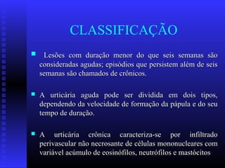 CLASSIFICAÇÃO
    Lesões com duração menor do que seis semanas são
    consideradas agudas; episódios que persistem além de seis
    semanas são chamados de crônicos.

   A urticária aguda pode ser dividida em dois tipos,
    dependendo da velocidade de formação da pápula e do seu
    tempo de duração.

   A urticária crônica caracteriza-se por infiltrado
    perivascular não necrosante de células mononucleares com
    variável acúmulo de eosinófilos, neutrófilos e mastócitos
 