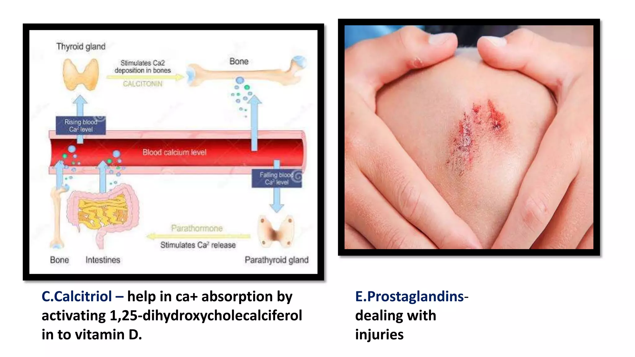 C.Calcitriol – help in ca+ absorption by
activating 1,25-dihydroxycholecalciferol
in to vitamin D.
E.Prostaglandins-
dealing with
injuries
 