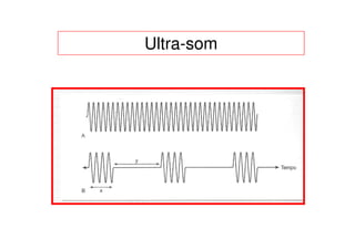 Ultra-som
 