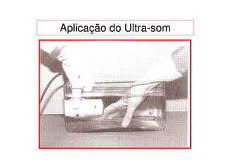 Aplicação do Ultra-som
 