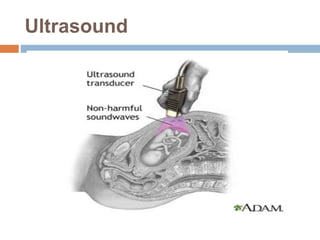 Ultrasound
 