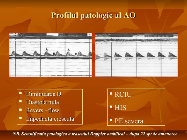 doppler ultrasound pregnancy for nclex doppler ultrasound pregnancy for nclex