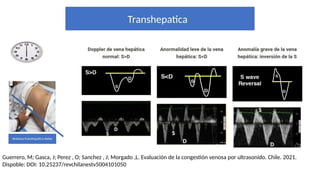 Transhepatica
Guerrero, M; Gasca, J; Perez , O; Sanchez , J; Morgado ,L. Evaluación de la congestión venosa por ultrasonido. Chile. 2021.
Dispoble: DOI: 10.25237/revchilanestv5004101050
 