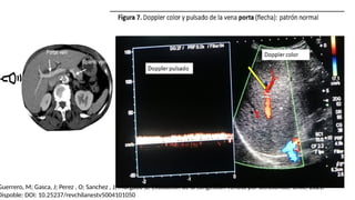 Guerrero, M; Gasca, J; Perez , O; Sanchez , J; Morgado ,L. Evaluación de la congestión venosa por ultrasonido. Chile. 2021.
Dispoble: DOI: 10.25237/revchilanestv5004101050
 