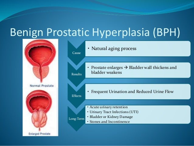 US 2014 Urology Procedure and Treatment - Us 2014 Urology Procedure And Treatment Report 4 638 