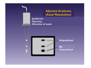 Example Axial Resolution Scan US 8 CUT USArtifacts resolution---------.ppt