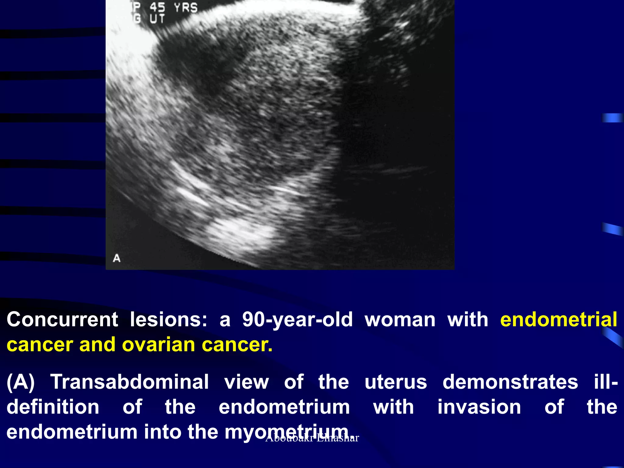 Uturus Graph Ultrasonography of the uterus | PDF