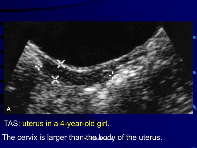 Uturus Graph Ultrasonography of the uterus | PDF | Pregnancy | Reproductive Health