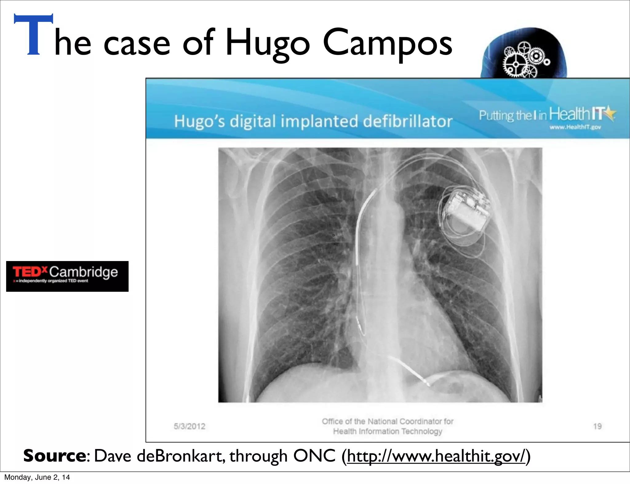 The case of Hugo Campos
Source: Dave deBronkart, through ONC (http://www.healthit.gov/)
Monday, June 2, 14
 