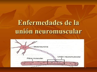 Enfermedades de laEnfermedades de la
unión neuromuscularunión neuromuscular
 