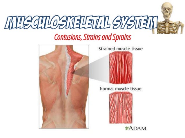 musculoskeletal system trauma