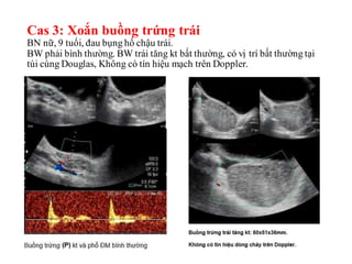 Hướng dẫn thực hành phân tích 1 khối u buồng
trứng trên MRI ( Practical MRI Analysis)
• Phân tích các chuỗi xung: T2 + T1/...