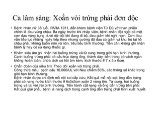Us and mri. xoan buong trung. ovarian torsion.drduong