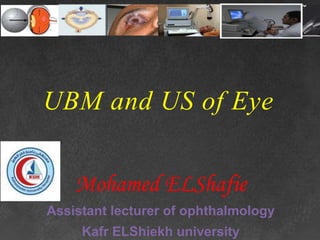 UBM and US of Eye
Mohamed ELShafie
Assistant lecturer of ophthalmology
Kafr ELShiekh university
 