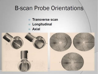 Us and UBM examination | PPTX