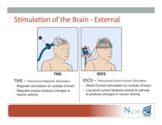 S-mula-on	
  of	
  the	
  Brain	
  -­‐	
  External	
  
TMS – Transcranial Magnetic Stimulation
•  Magnetic stimulation on outside of brain
•  Magnetic pulses produce changes in
neuron activity
tDCS – Transcranial Direct Current Stimulation
•  Direct Current stimulation on outside of brain
•  Low level current between anode & cathode
to produce changes in neuron activity
 