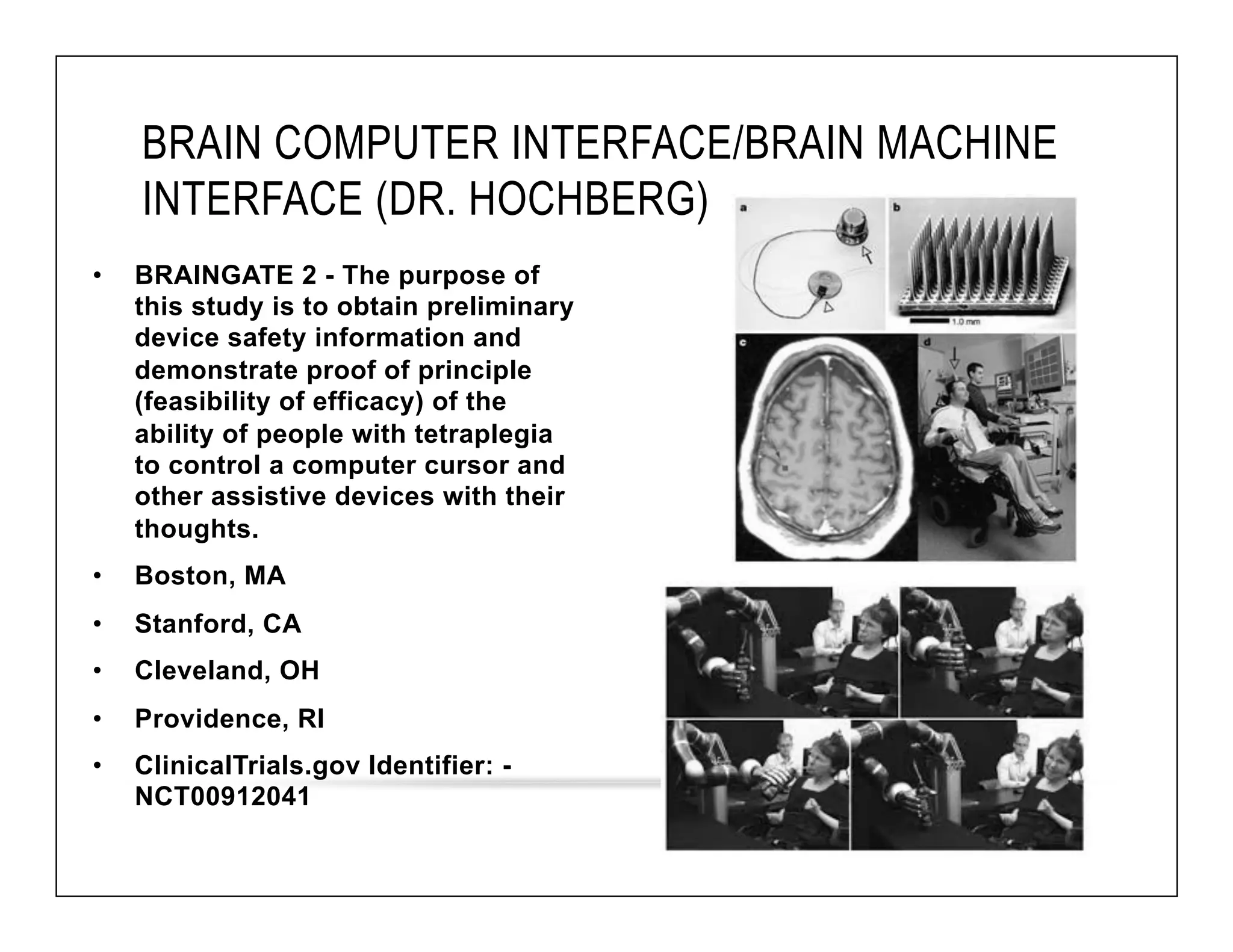 BRAIN COMPUTER INTERFACE/BRAIN MACHINE 
INTERFACE (DR. HOCHBERG) 
• BRAINGATE 2 - The purpose of 
this study is to obtain preliminary 
device safety information and 
demonstrate proof of principle 
(feasibility of efficacy) of the 
ability of people with tetraplegia 
to control a computer cursor and 
other assistive devices with their 
thoughts. 
• Boston, MA 
• Stanford, CA 
• Cleveland, OH 
• Providence, RI 
• ClinicalTrials.gov Identifier: - 
NCT00912041 
 