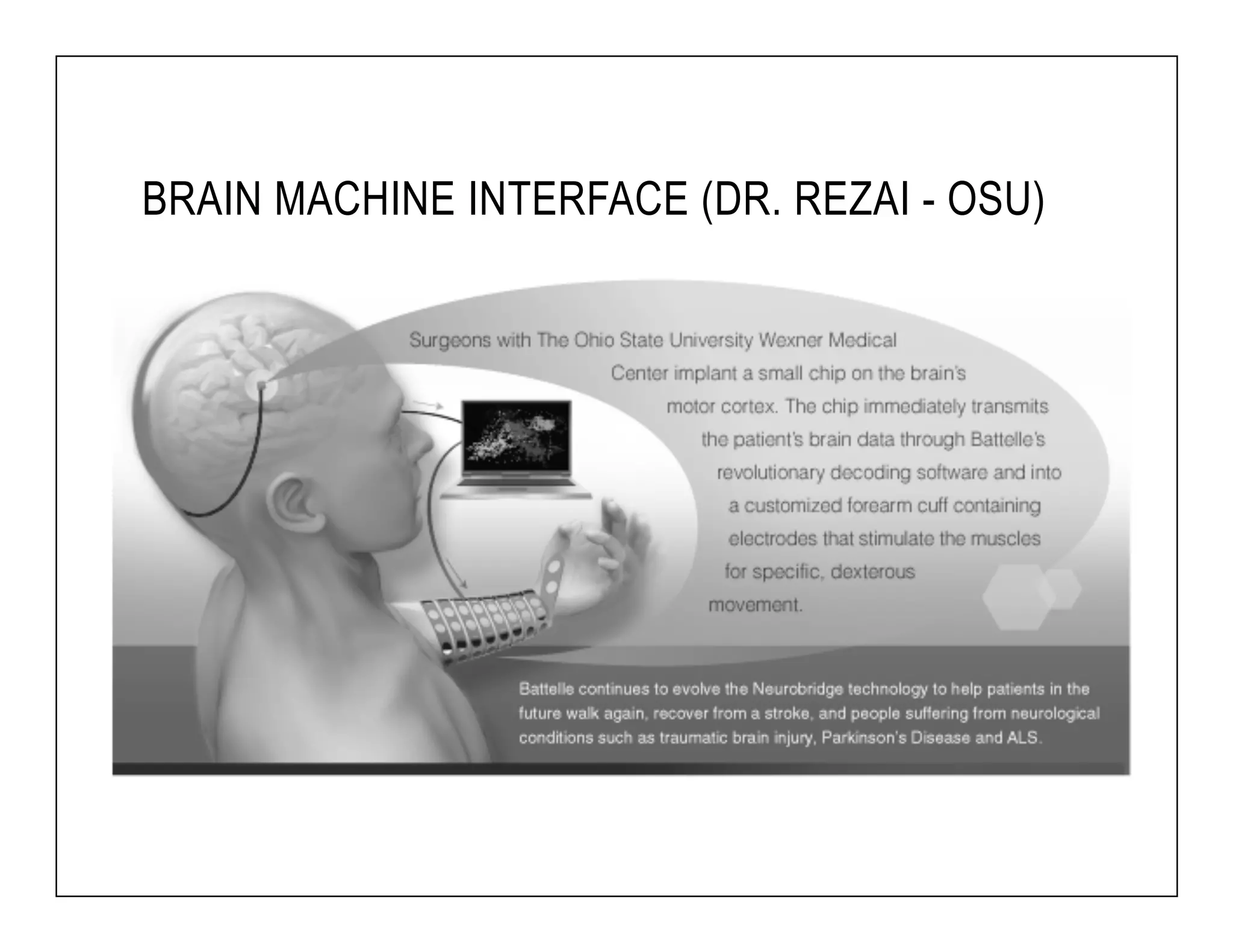 BRAIN MACHINE INTERFACE (DR. REZAI - OSU) 
 