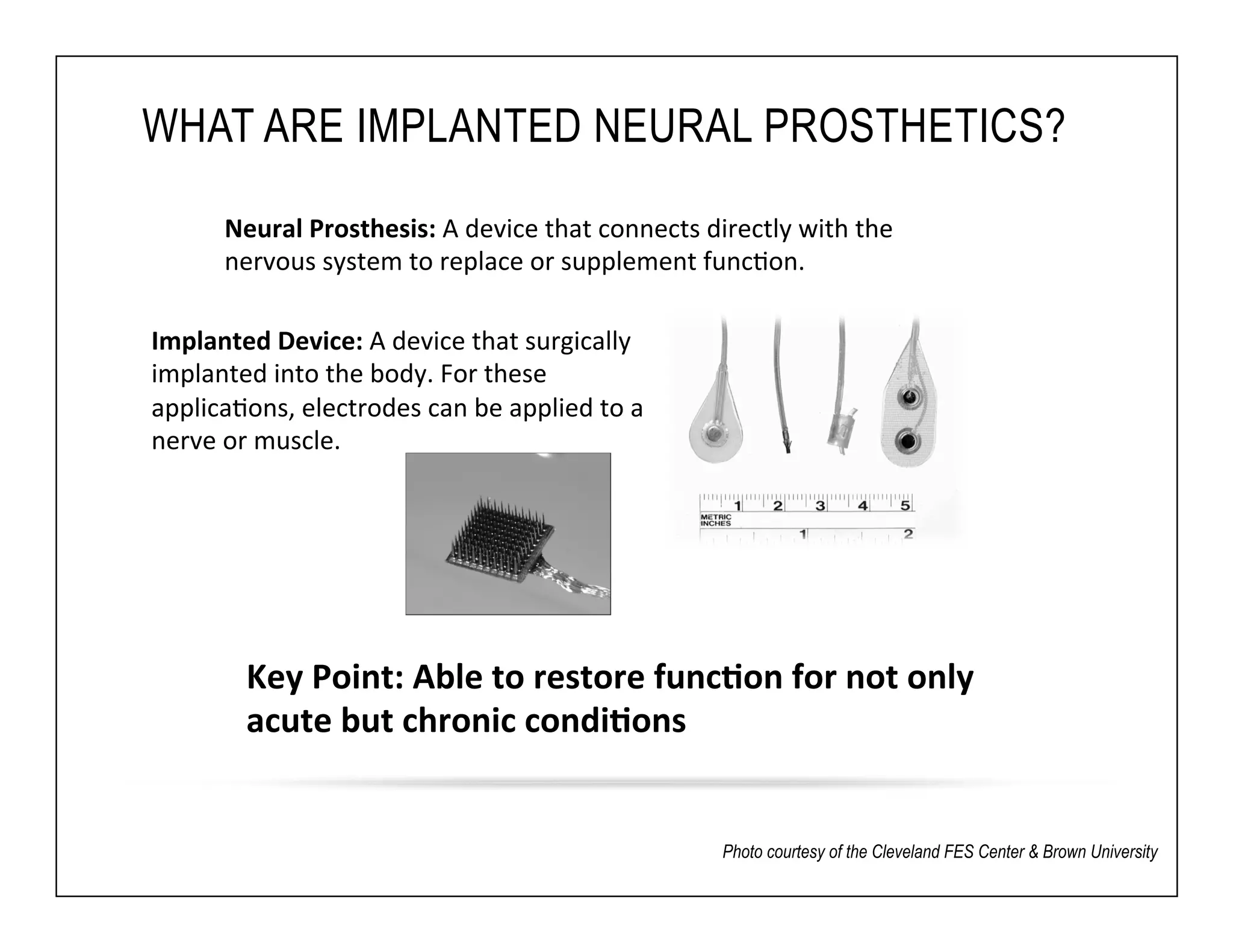 WHAT ARE IMPLANTED NEURAL PROSTHETICS? 
Neural 
Prosthesis: 
A 
device 
that 
connects 
directly 
with 
the 
nervous 
system 
to 
replace 
or 
supplement 
func6on. 
Key 
Point: 
Able 
to 
restore 
func6on 
for 
not 
only 
acute 
but 
chronic 
condi6ons 
Photo courtesy of the Cleveland FES Center & Brown University 
Implanted 
Device: 
A 
device 
that 
surgically 
implanted 
into 
the 
body. 
For 
these 
applica6ons, 
electrodes 
can 
be 
applied 
to 
a 
nerve 
or 
muscle. 
 