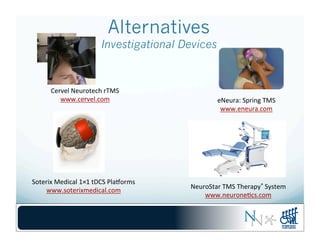 Alternatives
Investigational Devices
NeuroStar	
  TMS	
  Therapy®	
  System	
  
www.neurone-cs.com	
  
Soterix	
  Medical	
  1×1	
  tDCS	
  Plajorms	
  
www.soterixmedical.com	
  
Cervel	
  Neurotech	
  rTMS	
  
www.cervel.com	
   eNeura:	
  Spring	
  TMS	
  
www.eneura.com	
  
 