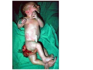 US CH 32 Carter 2019