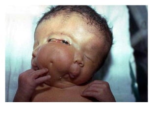 US CH 32 Carter 2019