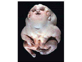 US CH 32 Carter 2019