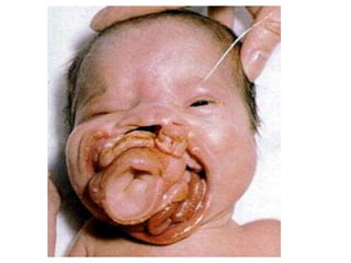 US CH 32 Carter 2019