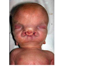 US CH 32 Carter 2019