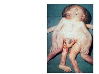 US CH 32 Carter 2019